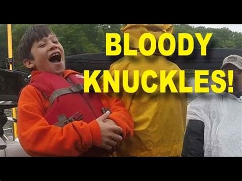 Kids Get Schooled in Bloody Knuckles .